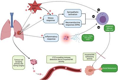Can Acute Postoperative Pain Management After Tumour <mark class="highlighted">Resection Surgery</mark> Modulate Risk of Later Recurrence or Metastasis?